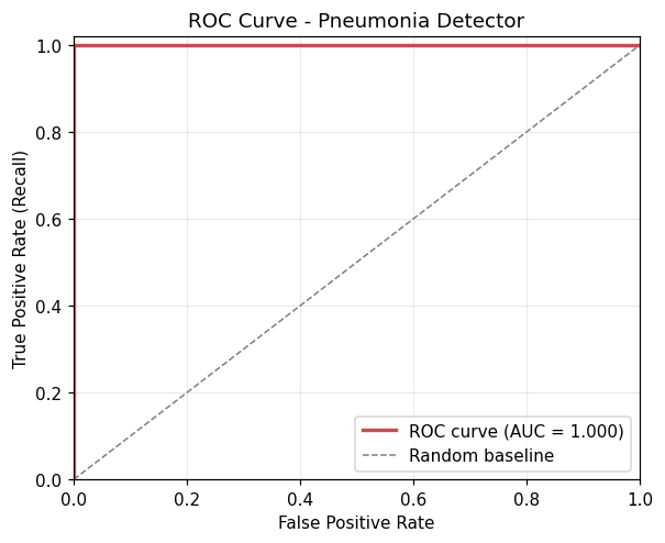 ROC Curve